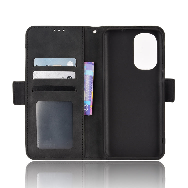 For Ulefone Note 13P Skin Feel Calf Pattern Leather Phone Case(Black) - Ulefone Cases by PMC Jewellery | Online Shopping South Africa | PMC Jewellery | Buy Now Pay Later Mobicred