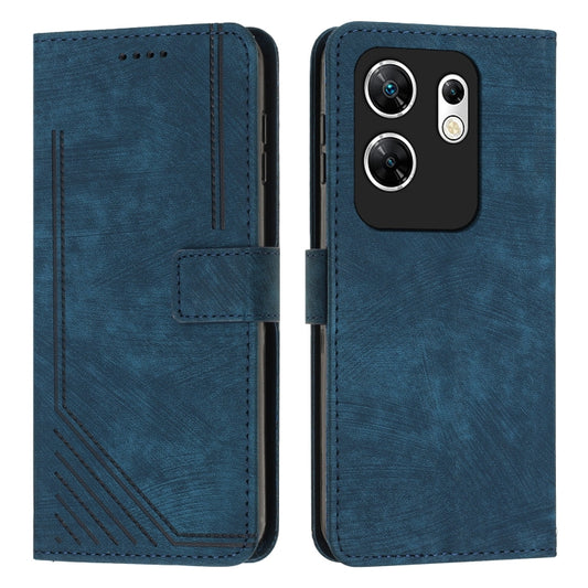 For Infinix Zero 30 4G Skin Feel Stripe Pattern Leather Phone Case with Lanyard(Blue) - Infinix Cases by PMC Jewellery | Online Shopping South Africa | PMC Jewellery | Buy Now Pay Later Mobicred