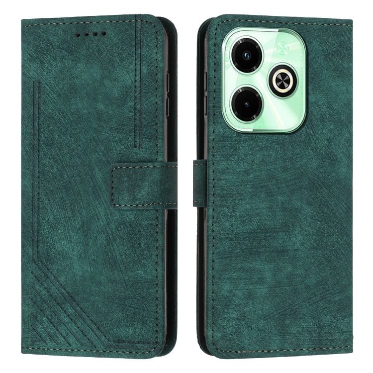 For Infinix Hot 40i Skin Feel Stripe Pattern Leather Phone Case with Lanyard(Green) - Infinix Cases by PMC Jewellery | Online Shopping South Africa | PMC Jewellery | Buy Now Pay Later Mobicred