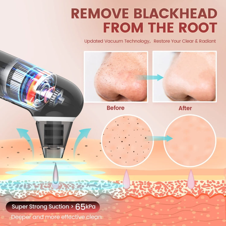 Electric Beauty Instrument Face Pore Remover Blackhead Acne Cleaner(Black) - Beauty Instrument by PMc TechLife | Online Shopping South Africa | PMc TechLife | Buy Now Pay Later Mobicred