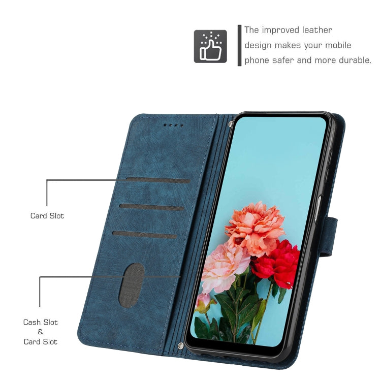 For Xiaomi Redmi Note 12 5G Global / Poco X5 5G Skin Feel Stripe Pattern Leather Phone Case with Lanyard(Blue) - free shipping - PMC TechLife - Order now!